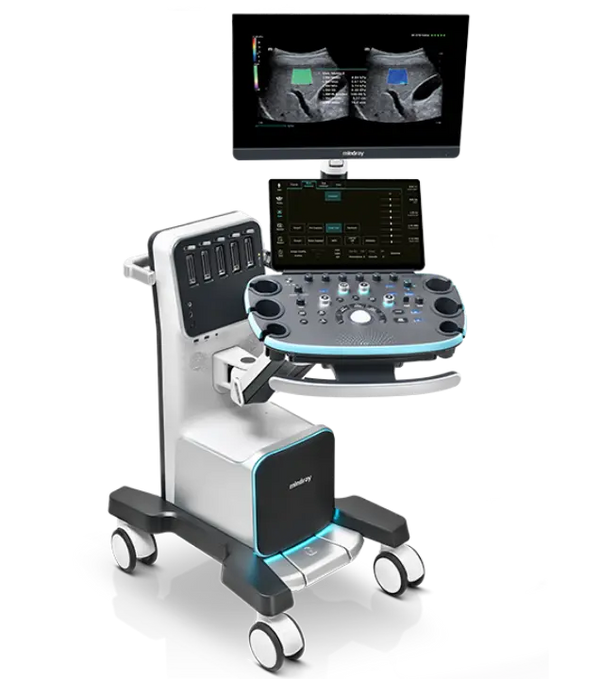 Equipo de ecocardiografía