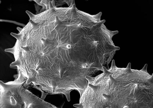 Microscopio electrónico