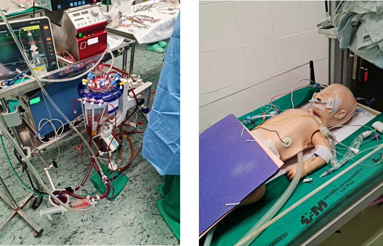 Dispositivo de soporte vital extracorpóreo (ECMO)